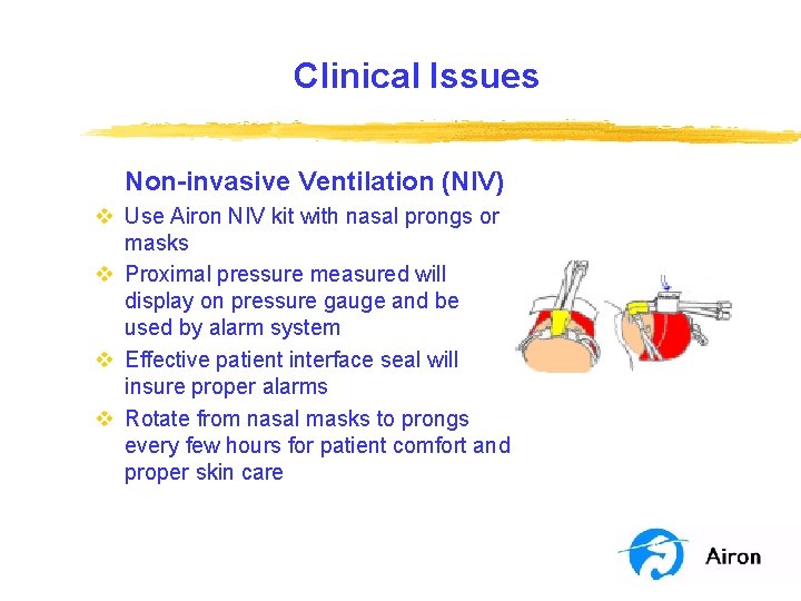 Clinical Issues Non-invasive Ventilation (NIV) v Use Airon NIV kit with nasal prongs or Clinical Issues Non-invasive Ventilation (NIV) v Use Airon NIV kit with nasal prongs or