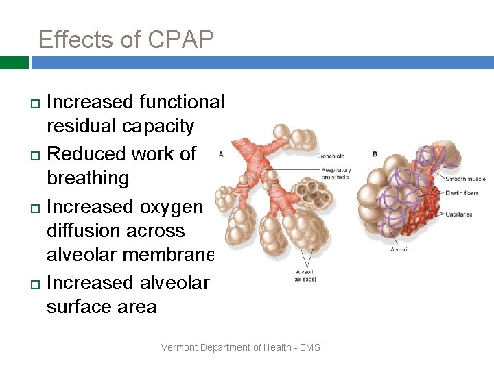 Effects of CPAP Increased functional residual capacity Reduced work of breathing Increased oxygen diffusion