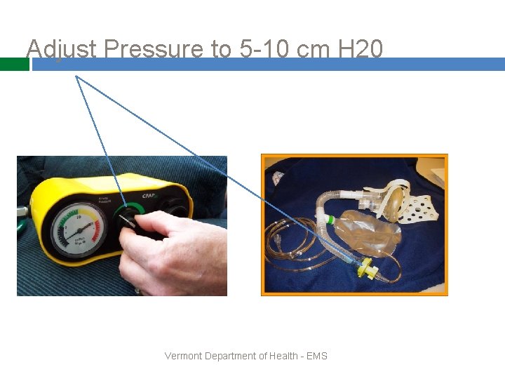 Adjust Pressure to 5 -10 cm H 20 Vermont Department of Health - EMS