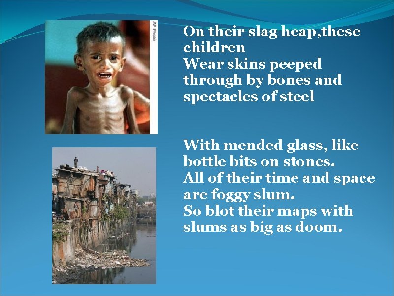 On their slag heap, these children Wear skins peeped through by bones and spectacles