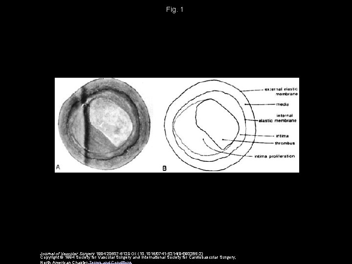 Fig. 1 Journal of Vascular Surgery 1994 20607 -612 DOI: (10. 1016/0741 -5214(94)90285 -2)