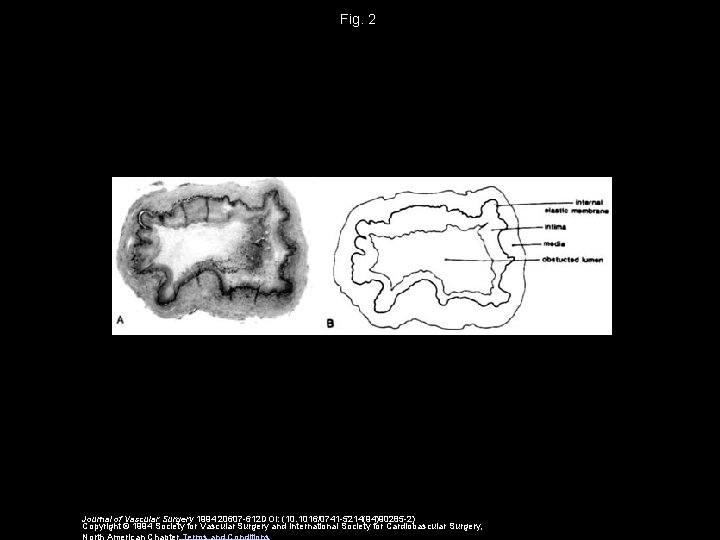 Fig. 2 Journal of Vascular Surgery 1994 20607 -612 DOI: (10. 1016/0741 -5214(94)90285 -2)