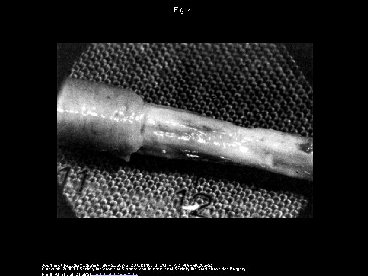 Fig. 4 Journal of Vascular Surgery 1994 20607 -612 DOI: (10. 1016/0741 -5214(94)90285 -2)