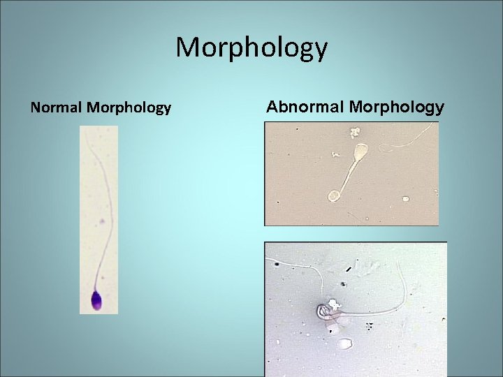 Morphology Normal Morphology Abnormal Morphology 