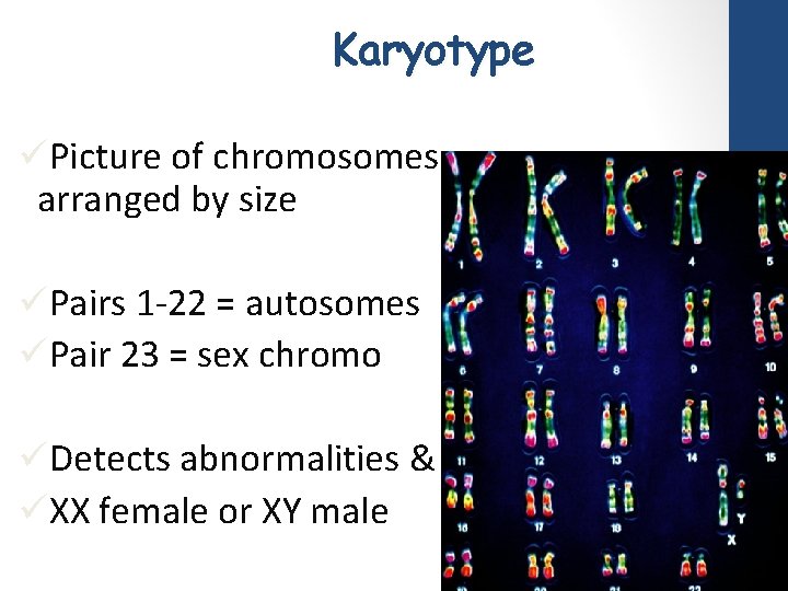 Karyotype üPicture of chromosomes arranged by size üPairs 1 -22 = autosomes üPair 23