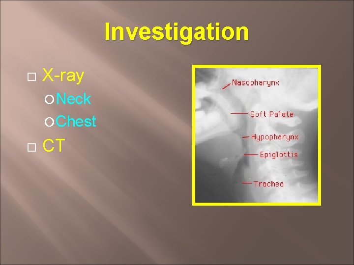 Investigation X-ray Neck Chest CT 