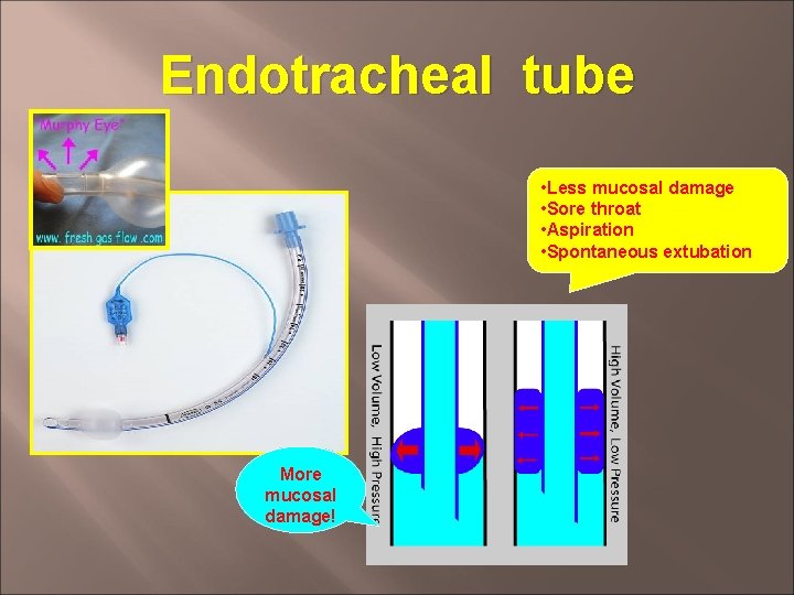 Endotracheal tube • Less mucosal damage • Sore throat • Aspiration • Spontaneous extubation