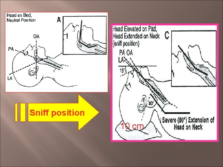 Sniff position 10 cm. 