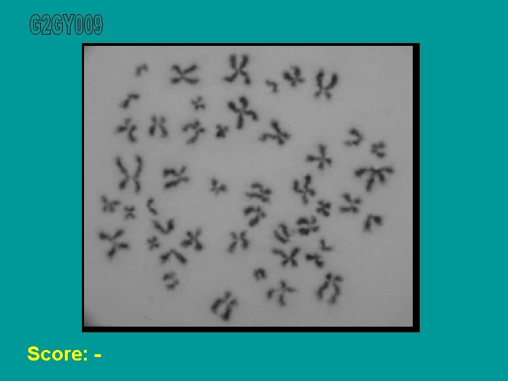 Score: - 