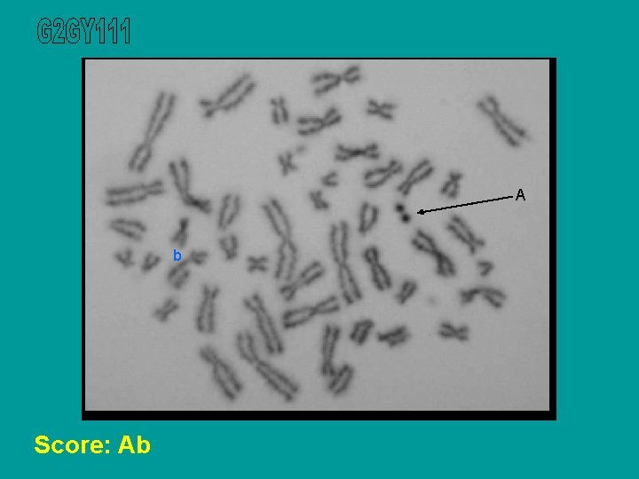 A b Score: Ab 