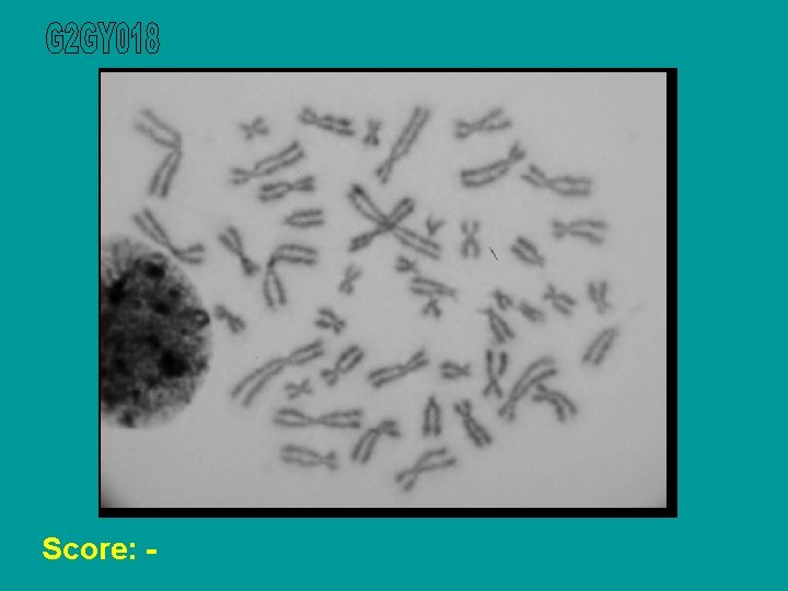 Score: - 