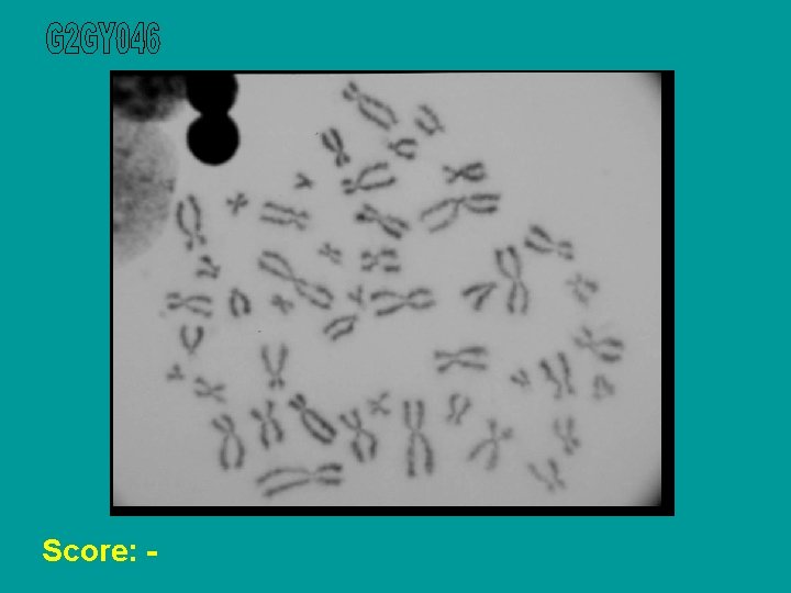 Score: - 