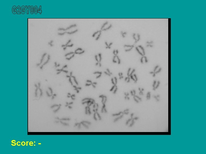 Score: - 