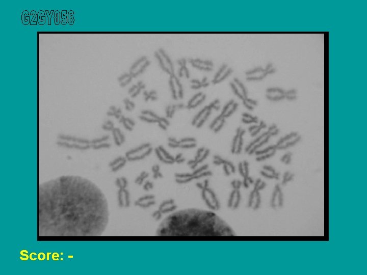 Score: - 