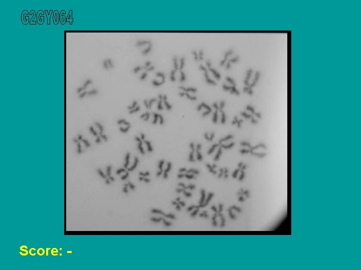 Score: - 