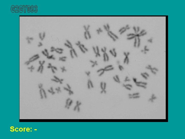 Score: - 