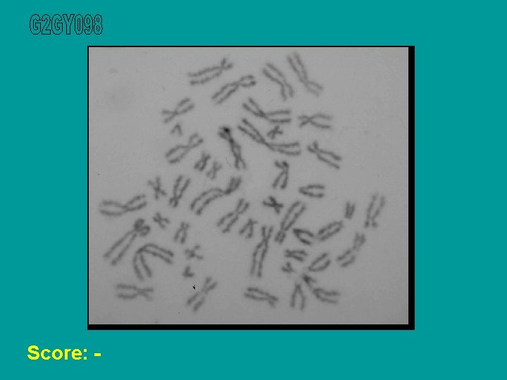 Score: - 