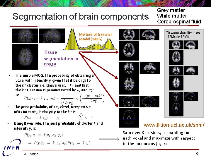 Segmentation of brain components Mixture of Gaussian Model (MOG) Grey matter White matter Cerebrospinal