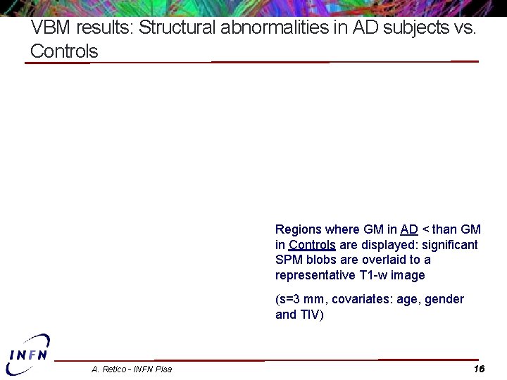 VBM results: Structural abnormalities in AD subjects vs. Controls Regions where GM in AD