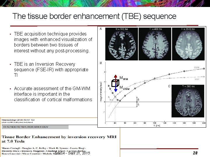 The tissue border enhancement (TBE) sequence • TBE acquisition technique provides images with enhanced