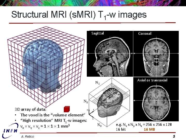 Structural MRI (s. MRI) T 1 -w images Sagittal Coronal Axial or transaxial 3