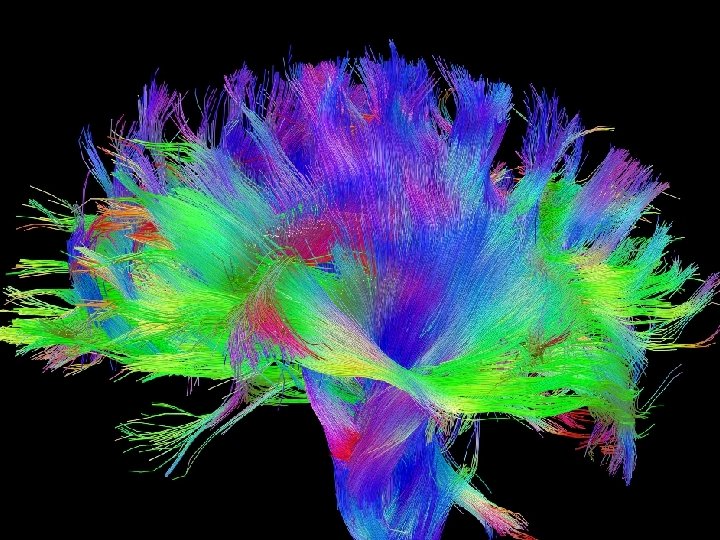Diffusion weighted imaging • Water molecules diffuse around during Isotropic diffusion Anisotropic diffusion the