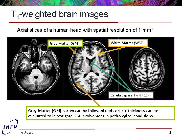 T 1 -weighted brain images Axial slices of a human head with spatial resolution