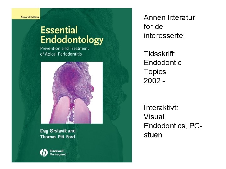 Annen litteratur for de interesserte: Tidsskrift: Endodontic Topics 2002 - Interaktivt: Visual Endodontics, PCstuen