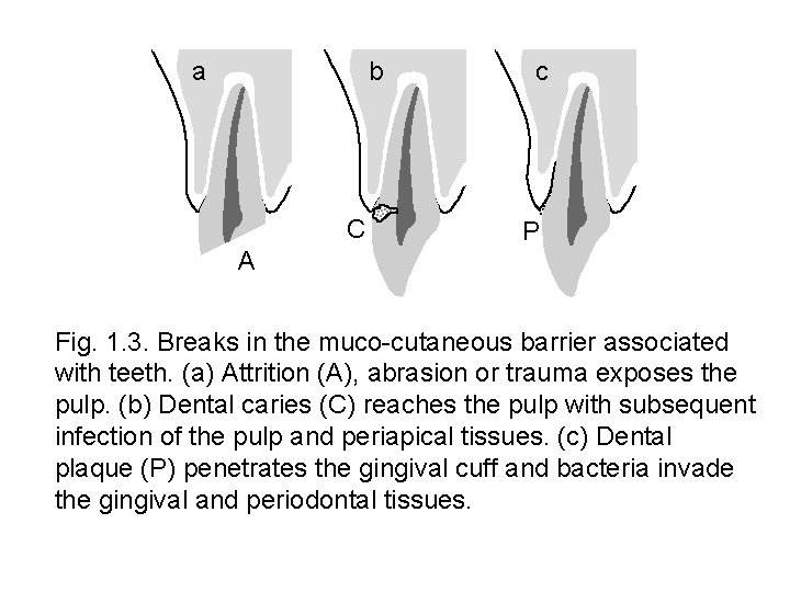 a b C c P A Fig. 1. 3. Breaks in the muco-cutaneous barrier