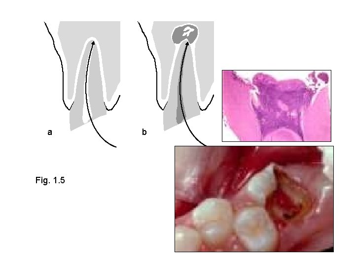 a Fig. 1. 5 b 