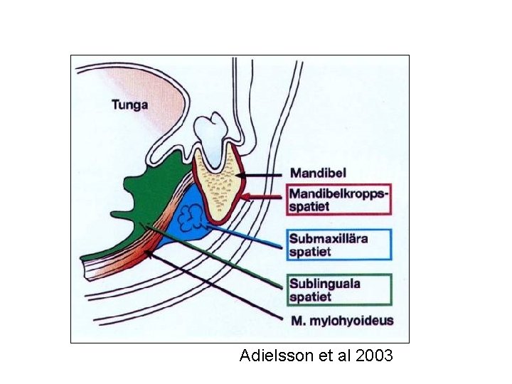 Adielsson et al 2003 