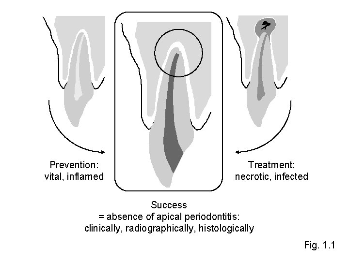 Prevention: vital, inflamed Treatment: necrotic, infected Success = absence of apical periodontitis: clinically, radiographically,