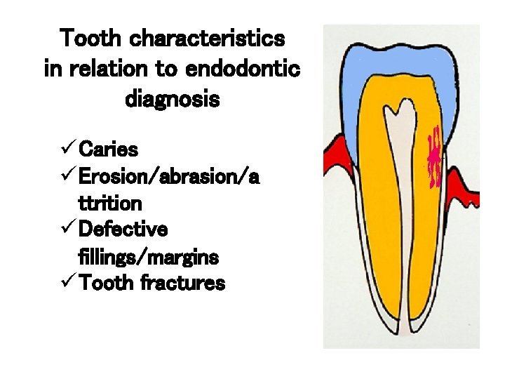 Tooth characteristics in relation to endodontic diagnosis ü Caries ü Erosion/abrasion/a ttrition ü Defective