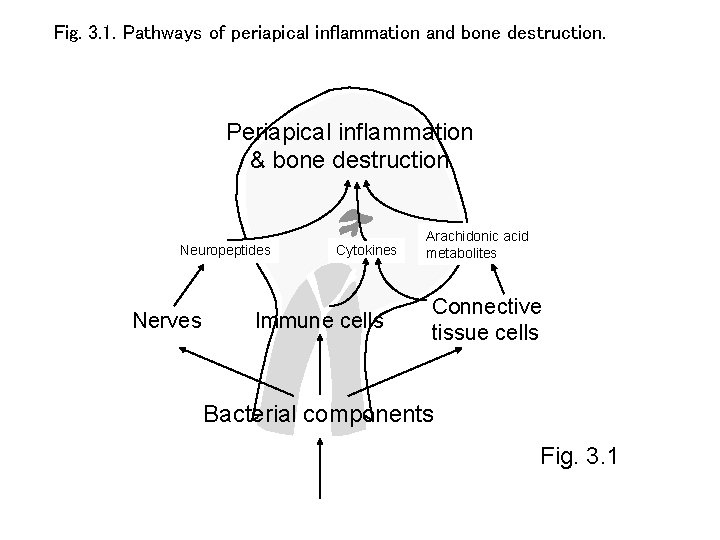 Fig. 3. 1. Pathways of periapical inflammation and bone destruction. Periapical inflammation & bone