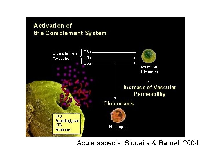Acute aspects; Siqueira & Barnett 2004 
