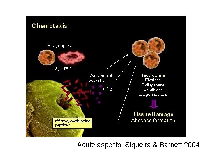 Acute aspects; Siqueira & Barnett 2004 