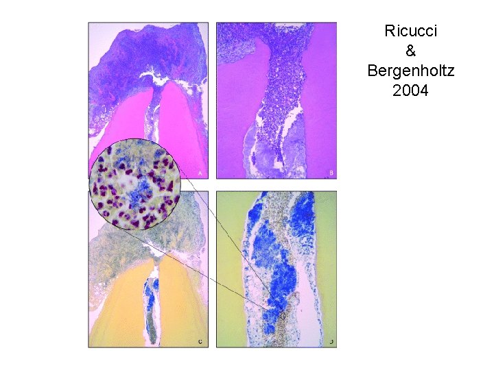 Ricucci & Bergenholtz 2004 