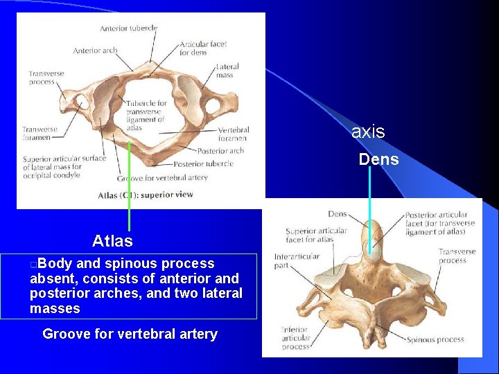 axis Dens Atlas Body and spinous process absent, consists of anterior and posterior arches,