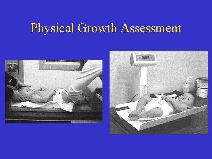 Physical Growth Assessment 