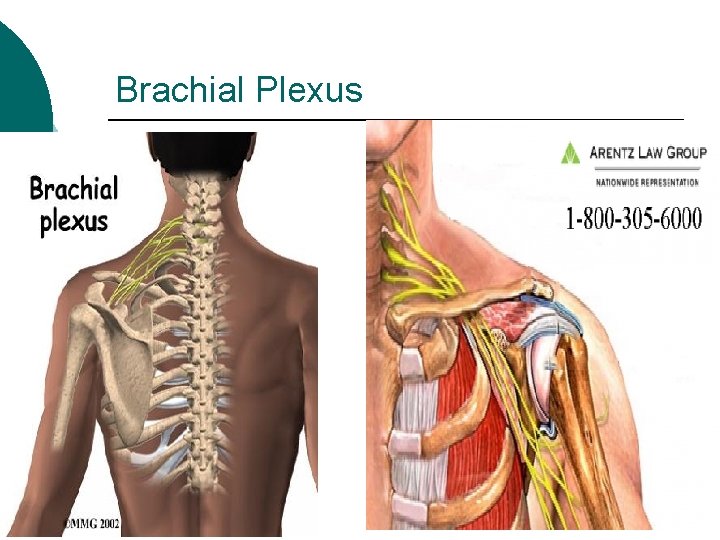 Brachial Plexus 