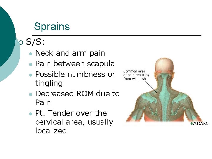 Sprains ¡ S/S: l l l Neck and arm pain Pain between scapula Possible