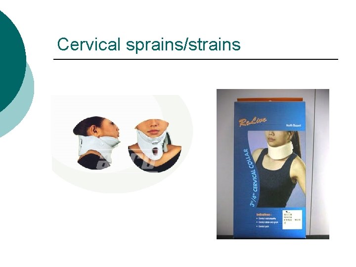 Cervical sprains/strains 