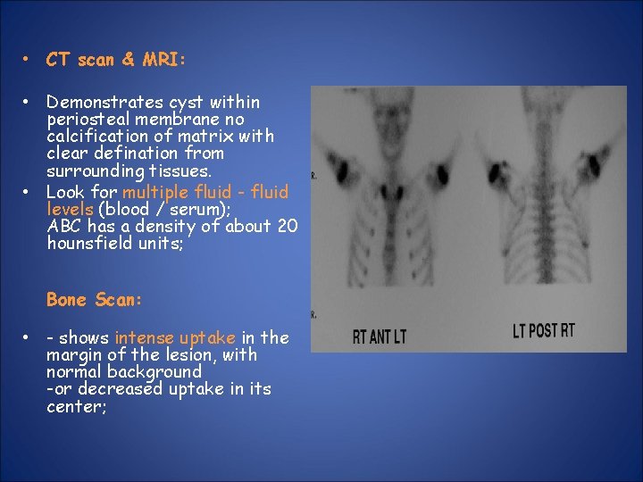  • CT scan & MRI: • Demonstrates cyst within periosteal membrane no calcification