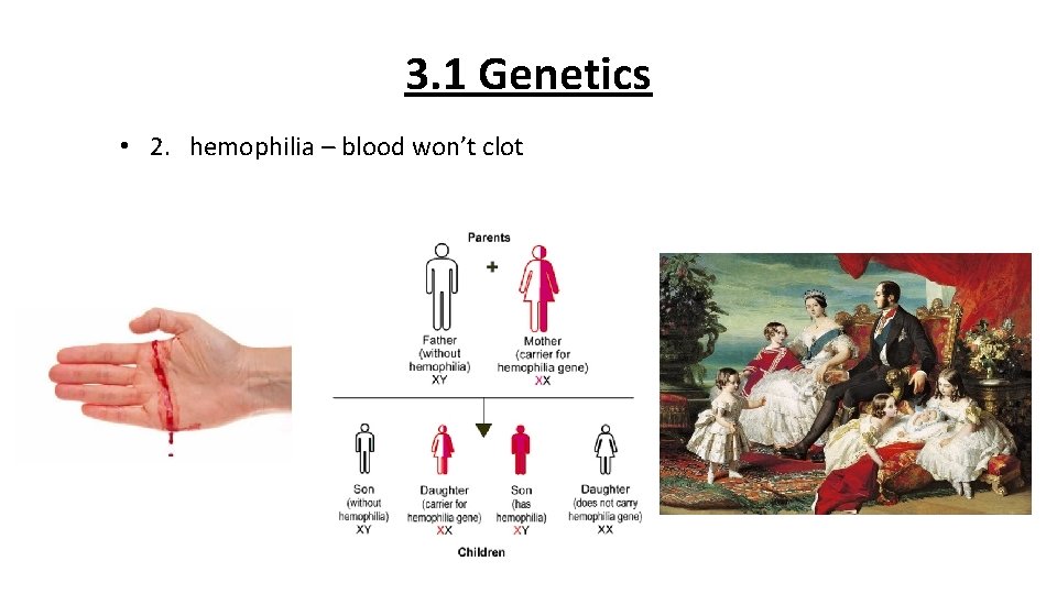 3. 1 Genetics • 2. hemophilia – blood won’t clot 