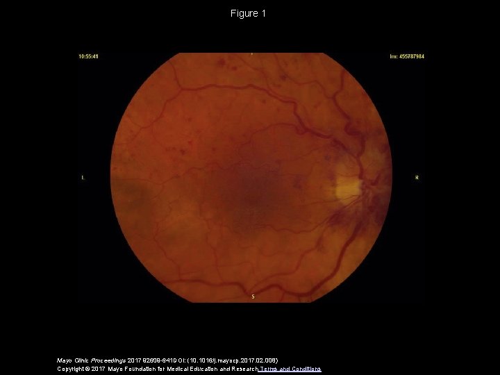 Figure 1 Mayo Clinic Proceedings 2017 92609 -641 DOI: (10. 1016/j. mayocp. 2017. 02.