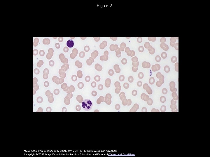 Figure 2 Mayo Clinic Proceedings 2017 92609 -641 DOI: (10. 1016/j. mayocp. 2017. 02.