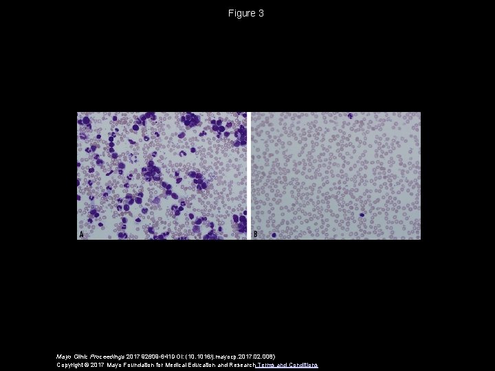 Figure 3 Mayo Clinic Proceedings 2017 92609 -641 DOI: (10. 1016/j. mayocp. 2017. 02.