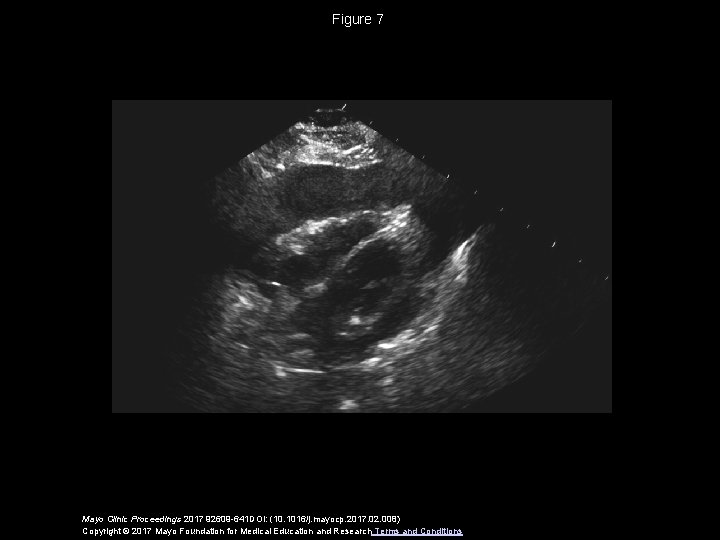 Figure 7 Mayo Clinic Proceedings 2017 92609 -641 DOI: (10. 1016/j. mayocp. 2017. 02.