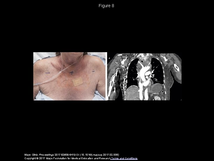 Figure 8 Mayo Clinic Proceedings 2017 92609 -641 DOI: (10. 1016/j. mayocp. 2017. 02.