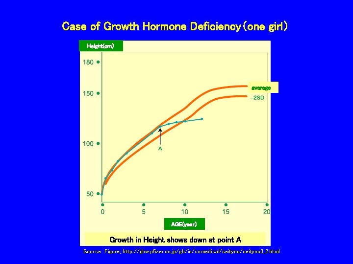 Case of Growth Hormone Deficiency（one girl） Height(cm） average AGE(year） Growth in Height shows down